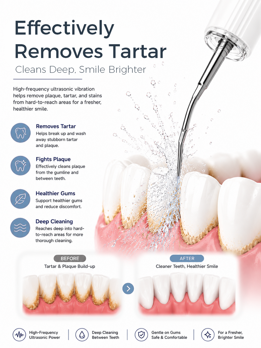 AquaPulse S2 removes tartar and plaque before after image